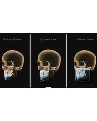 Рентген томограф ORTHOPHOS S 3D 11х10, объем съемки: 5х5,5, 8х8, 11х10см (Dentsply Sirona)