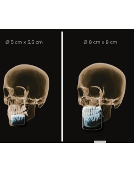 ORTHOPHOS S 3D 8 Х 8