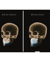 ORTHOPHOS S 3D 8 Х 8