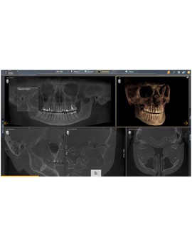 AXEOS 17x13 DCS CEPH