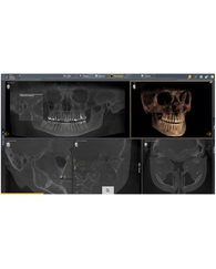 AXEOS 17x13 DCS CEPH