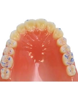 Arti-Check Box with strips, 200 strips, Blue, 40 µm