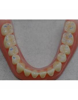 Arti-Check Box with strips, 200 strips, Blue/Red, 40 µm