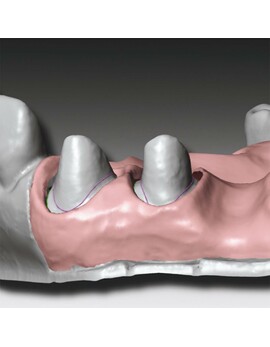 Скануючий м'який А-силікон GingiFast CAD Elastic, 2 картриджа по 50 мл