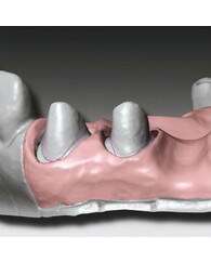 Скануючий м'який А-силікон GingiFast CAD Elastic, 2 картриджа по 50 мл