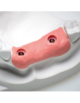 Твердий А-силікон GingiFast Rigid, 2 картриджа по 50 мл