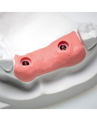 Твердий А-силікон GingiFast Rigid, 2 картриджа по 50 мл
