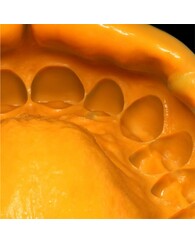 Oranwash (Оранваш), корригирующая оттискная масса для С-силикона Zeta Plus, 140 мл