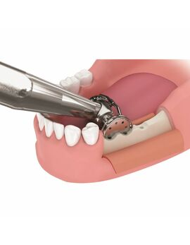 Micro Saw Shield MICSA 13S
